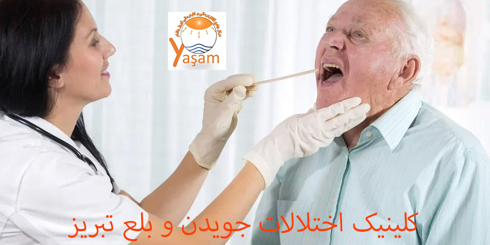 بلع موثر
