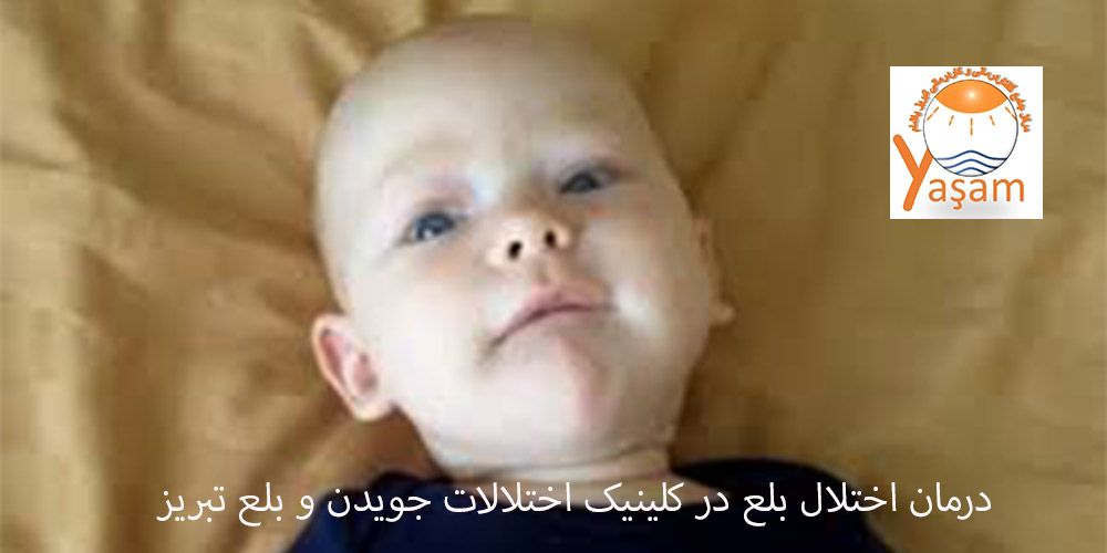 لب زدن یا لیپ اسماکینگ