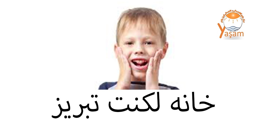 تکنیک دی سی ام