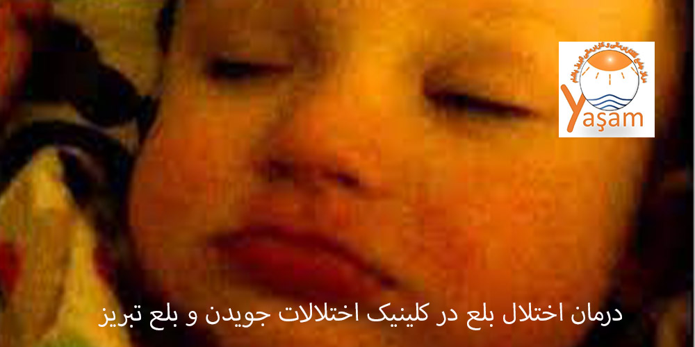 لب زدن یا لیپ اسماکینگ
