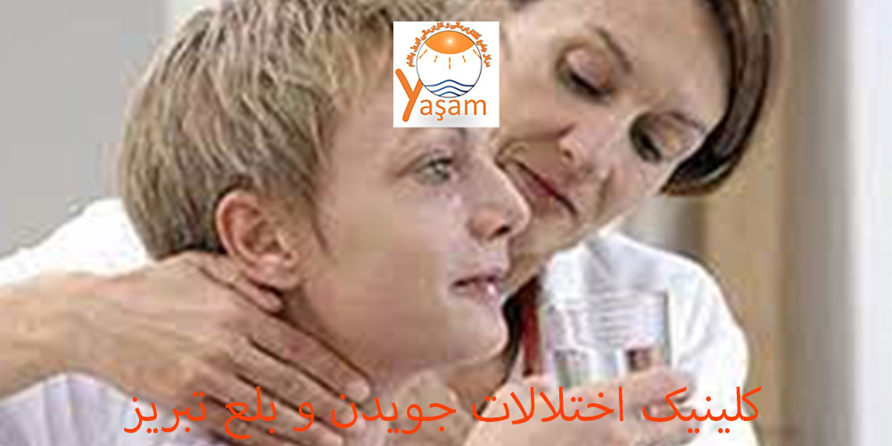 بلع موثر