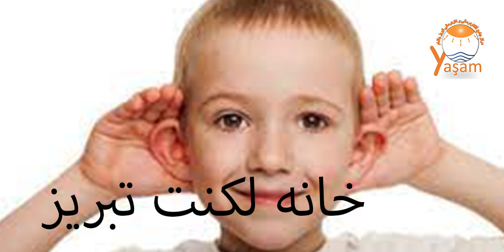 تکنیک دی سی ام