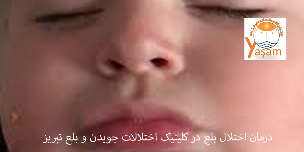 لب زدن یا لیپ اسماکینگ