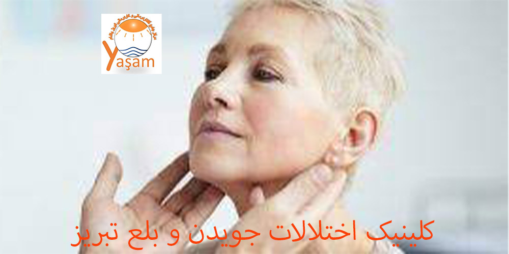 بلع موثر