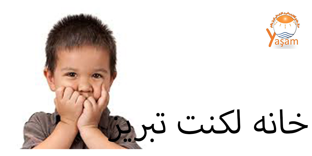 تکنیک دی سی ام