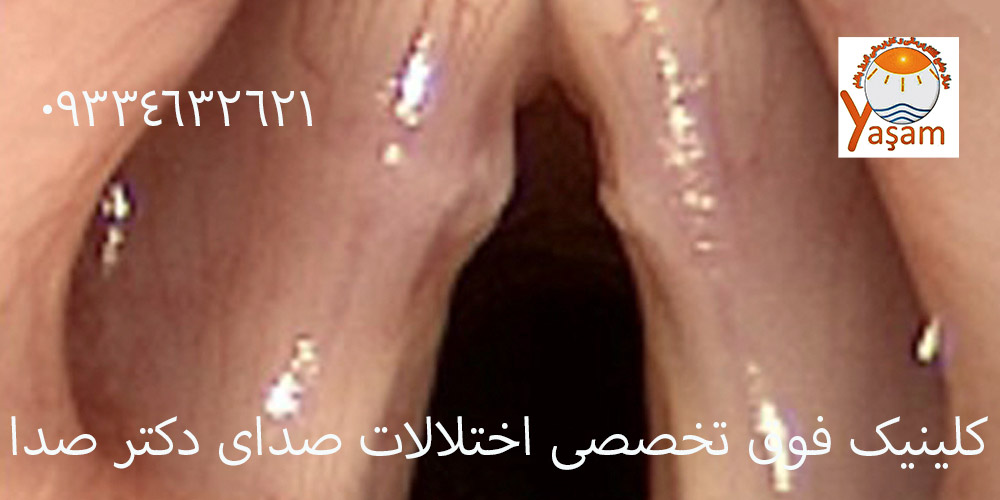 مربیان استخر و کیست صوتی
