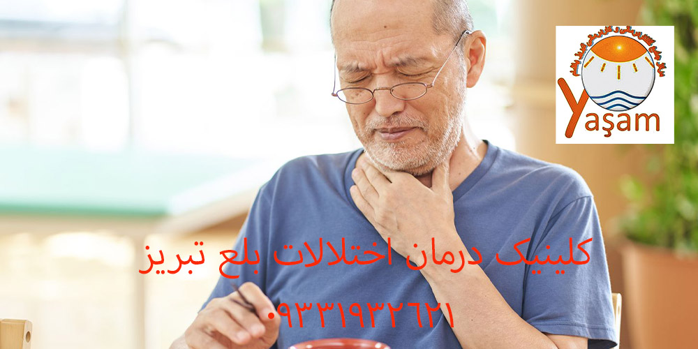 بلع