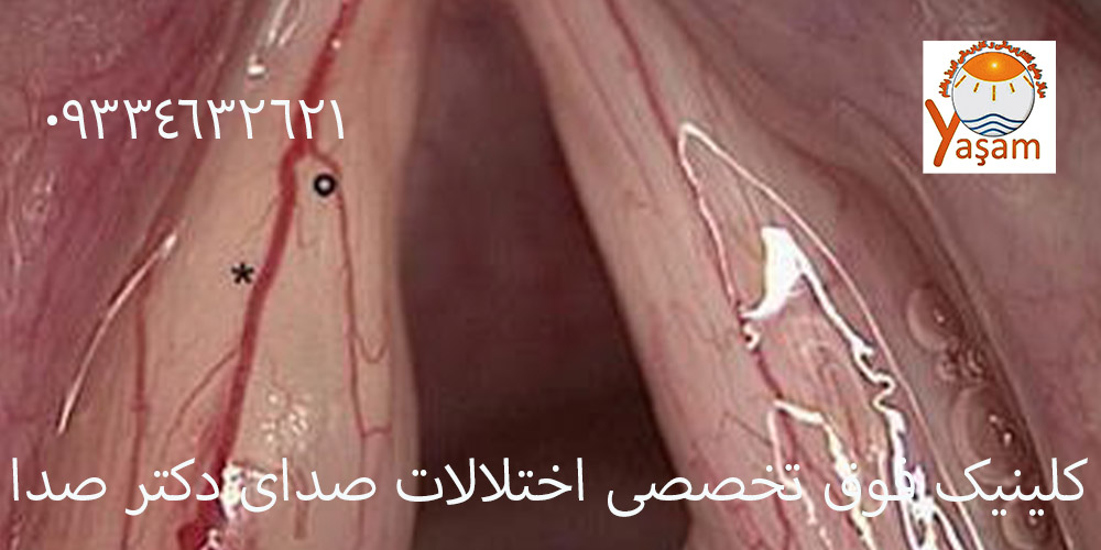 مربیان استخر و کیست صوتی