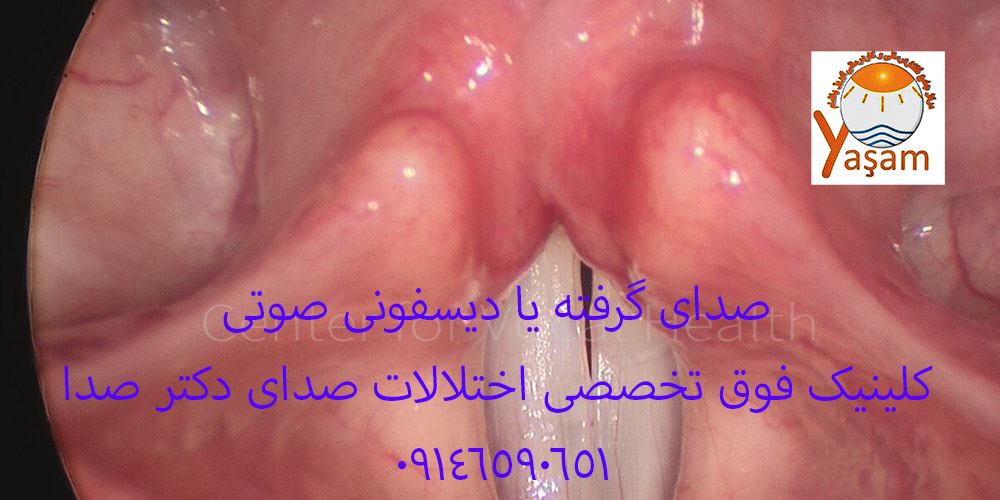 صدای گرفته